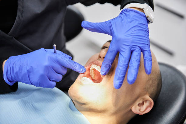 Best Emergency Dental Care for Sports Injuries in Kearns, UT